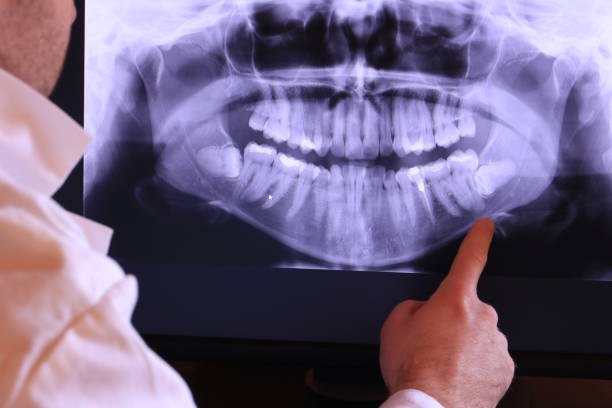 Best Emergency Root Canal Therapy in Bourbon, MO
